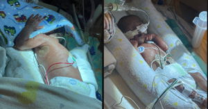 Two premature babies laying in an isolette