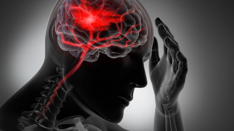 Person experiencing a stroke